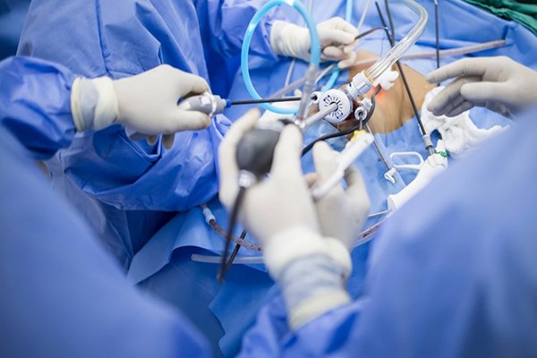 Advanced Endoscopic Procedures